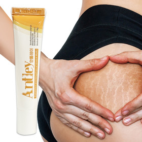 튼살크림 - 출산준비물